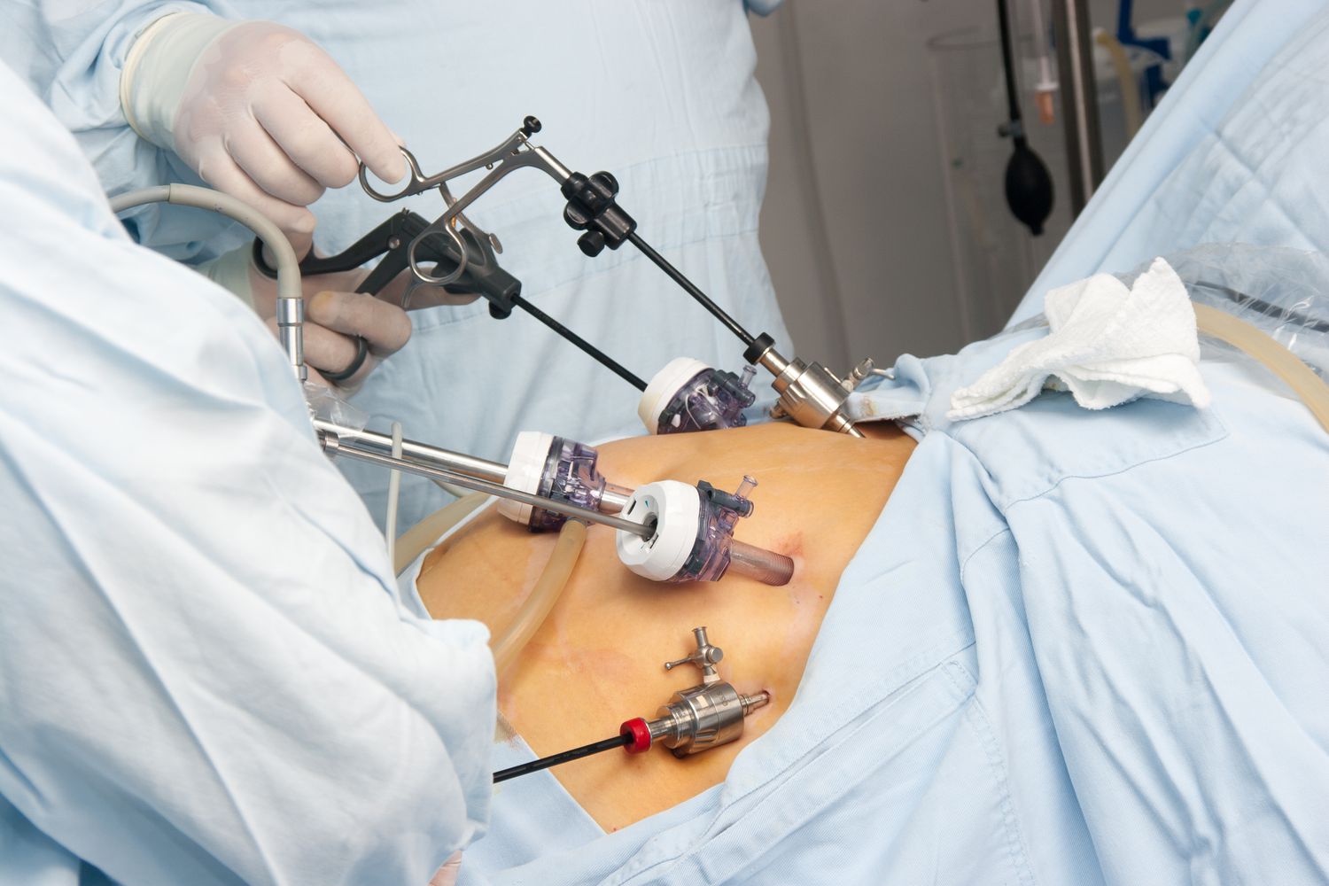 Cirurgia Bariátrica