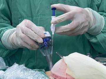 Clinical Surgery Video